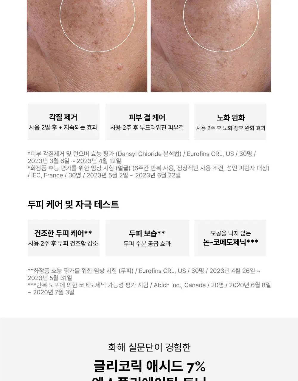 [각질쓱싹] 디오디너리 글리코릭 애시드 7% 엑스폴리에이팅 토너 240ml 상세페이지 4
